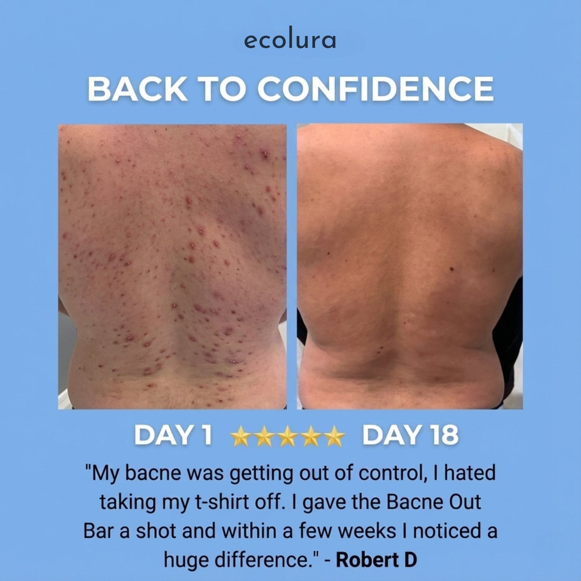 Bacne Out Soap Bar™ Ecolura 