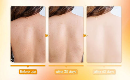 Bacne Out Soap Bar™ Ecolura 