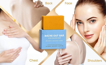 Bacne Out Soap Bar™ Ecolura 