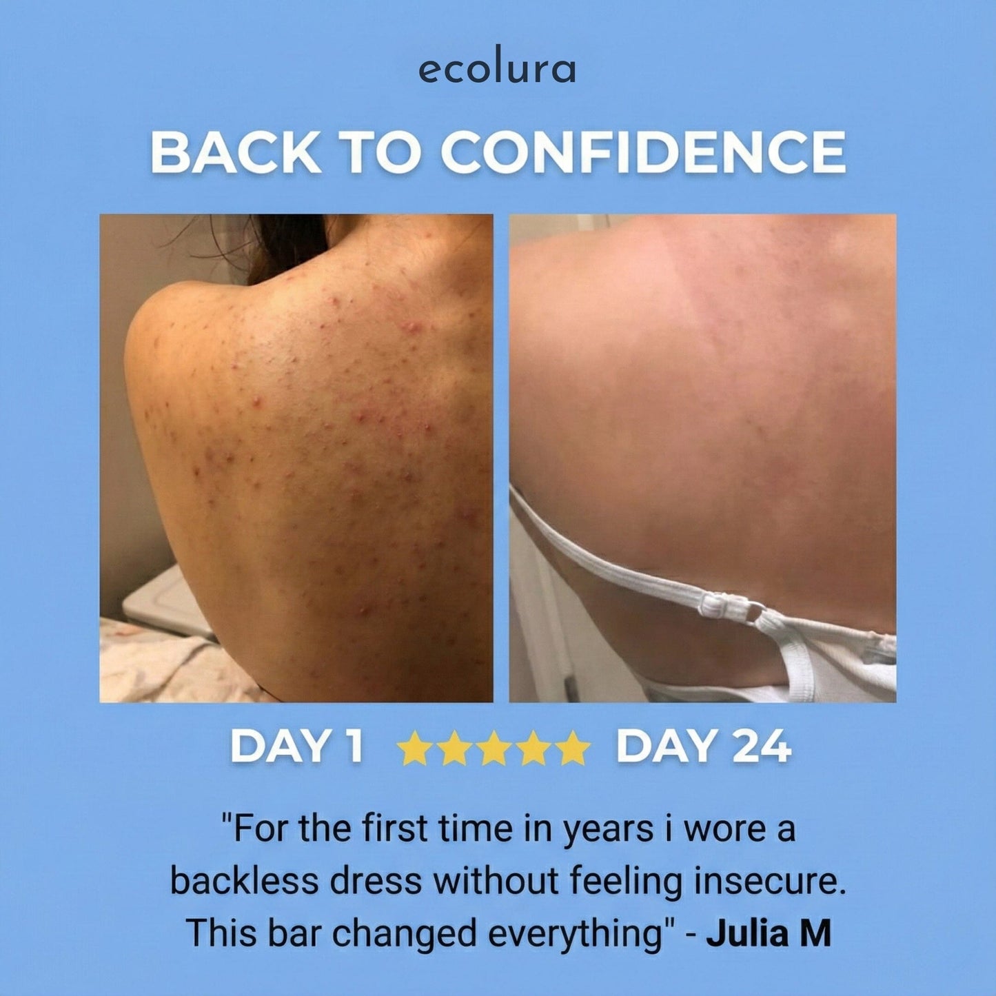 Bacne Out Soap Bar™ Ecolura 