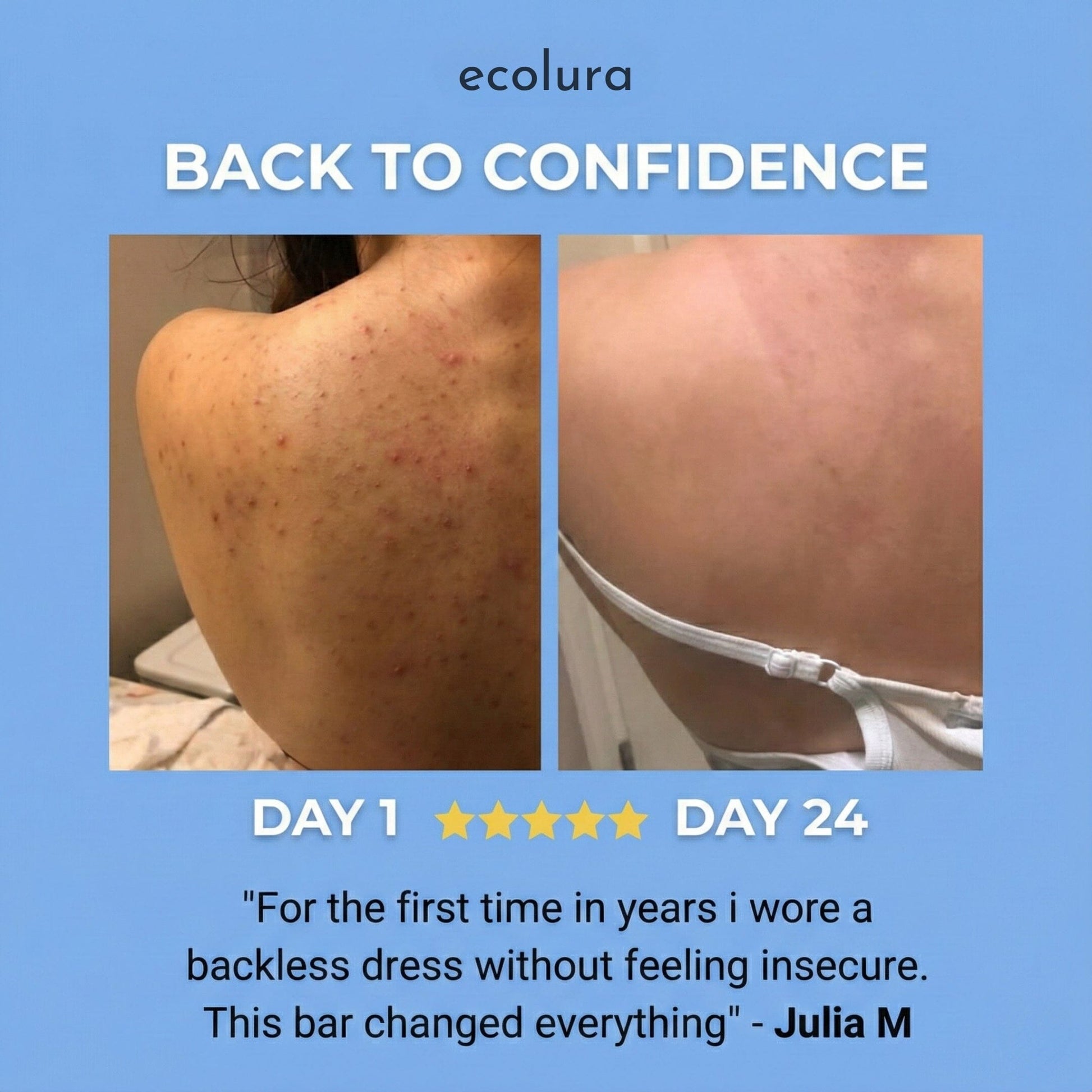 Bacne Out Soap Bar™ Ecolura 